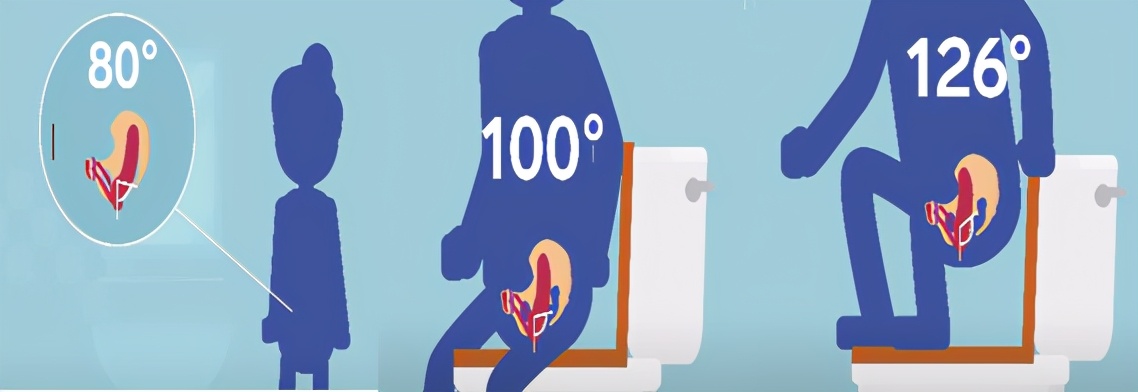 粪便种类分析,粪便七种形状