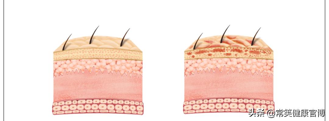 t细胞治癌最新成果,nk细胞治癌成功案例