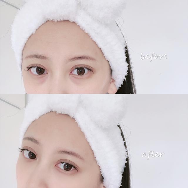 五款网红推荐的眼霜,卡珀雅天山雪莲逆龄抗衰眼霜