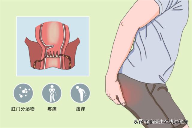 肛瘘手术快愈合了为什么有点痛,为什么肛瘘手术后才是痛苦的开始