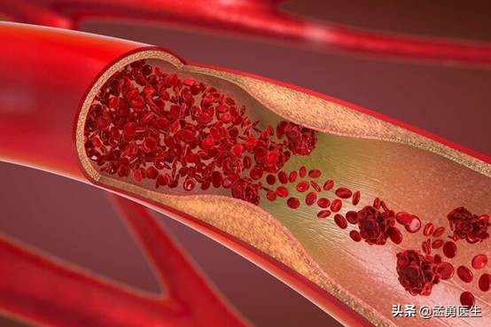 60岁要注意什么健康,60岁男性健康知识讲解