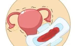 倪海厦治疗月经量少,温经汤治疗月经量少