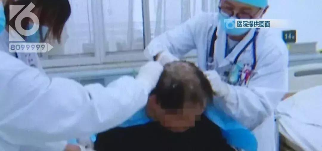 敌敌畏中毒解救,敌敌畏洗头中毒几天能痊愈