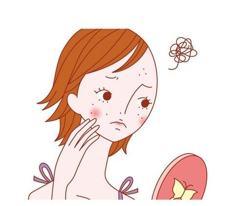 护肤小知识脸部痘痘篇,护肤小知识大全祛痘产品