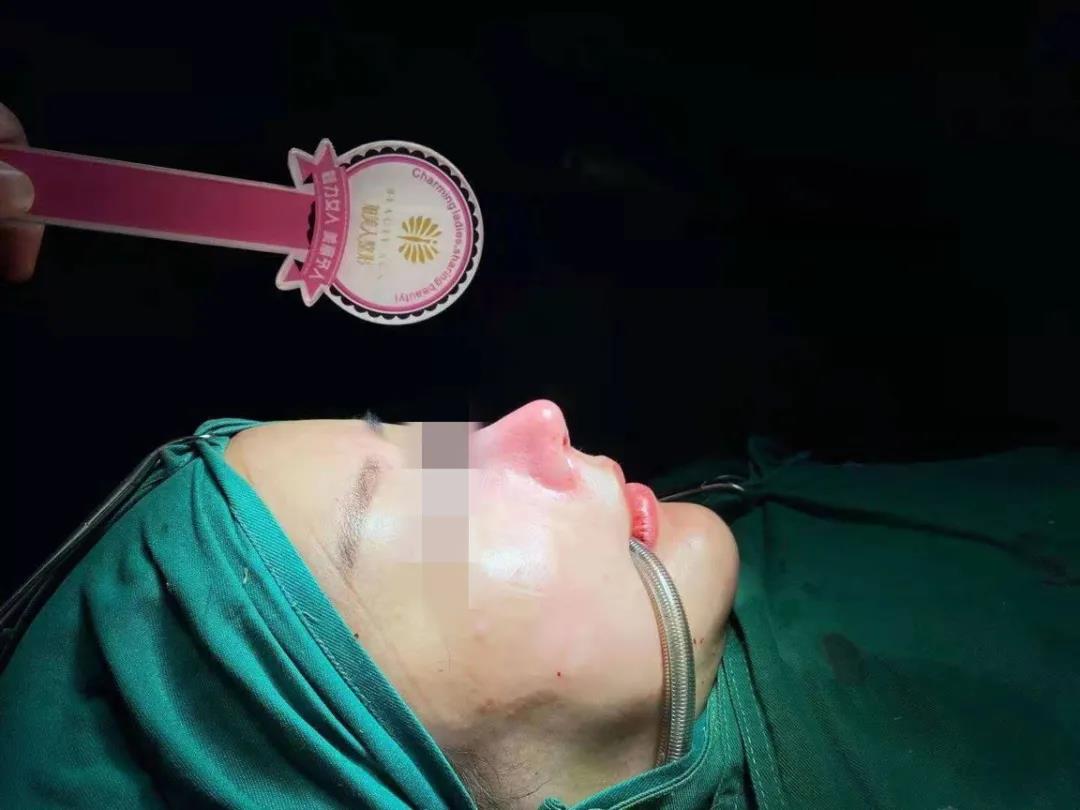 流浓鼻涕还散发臭味!昆明一女子整容后发现鼻腔内留有异物:无法见人...