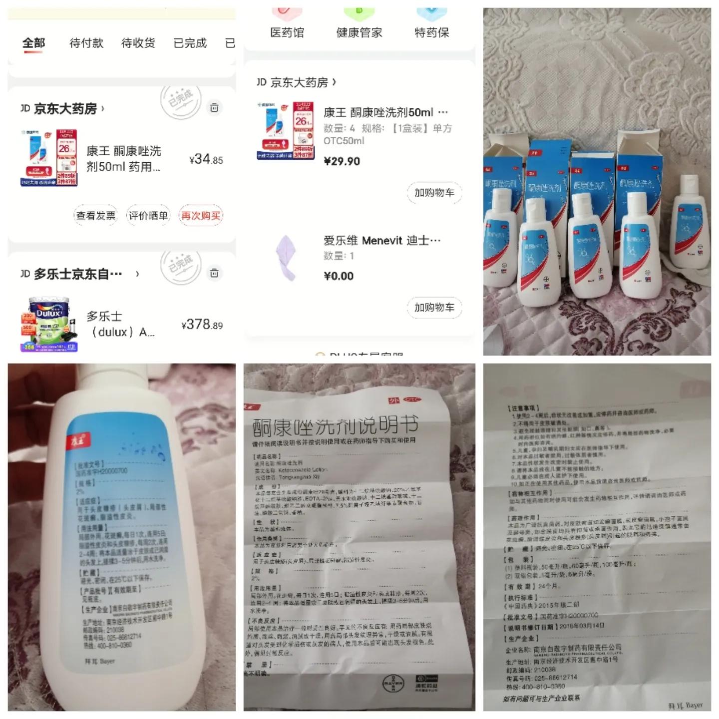 我的脱发,我的脱发治疗经历