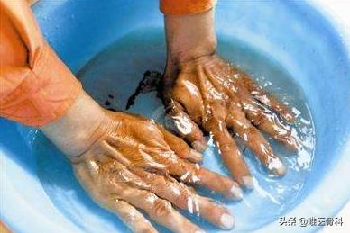 手指僵硬骨关节炎的治疗,手指关节肿大是骨关节炎能治好吗