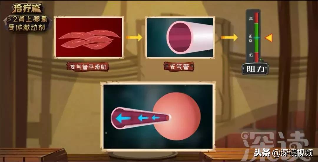 治慢阻肺最有效的偏方,咳喘良方