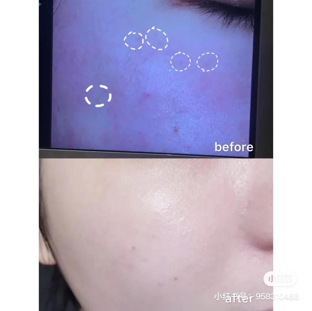 几十块美白精华100ml,几十块的变白护肤品