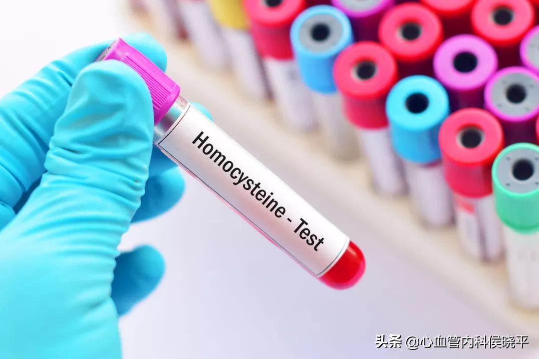 高血压同型半胱氨酸高吃叶酸5mg,高血压同型半胱氨酸吃多少叶酸
