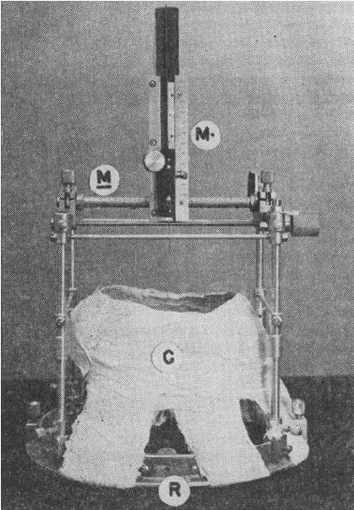 帕金森患者脑深部电刺激护理,帕金森脑深部电刺激手术步骤