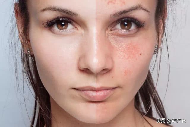 女生脸突然发黄是怎么了,最近女生脸上t区发黄怎么办