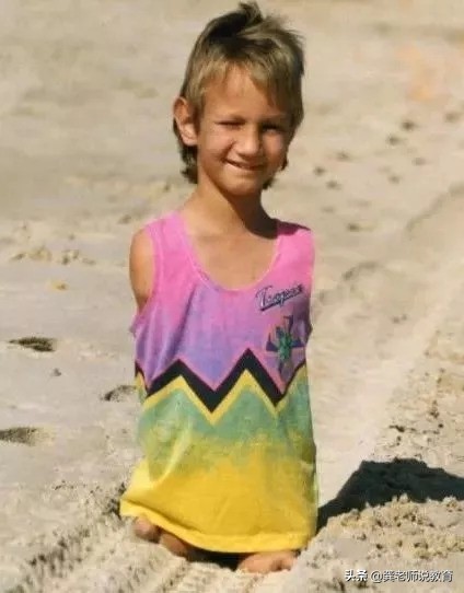 没有四肢的生命斗士,他没有腿但他却能坚强地站起来