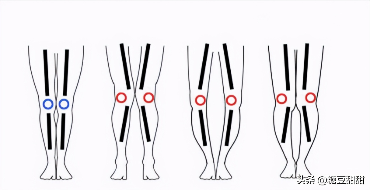 小腿脚踝变细的方法,小粗腿没腿