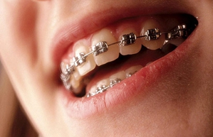 牙齿整齐但不对称,牙齿整齐就是不好看