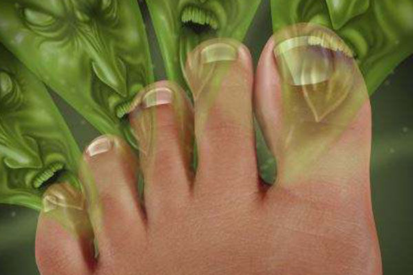 教你十招治疗脚气的方法,治疗脚气的几个误区看你中招了吗