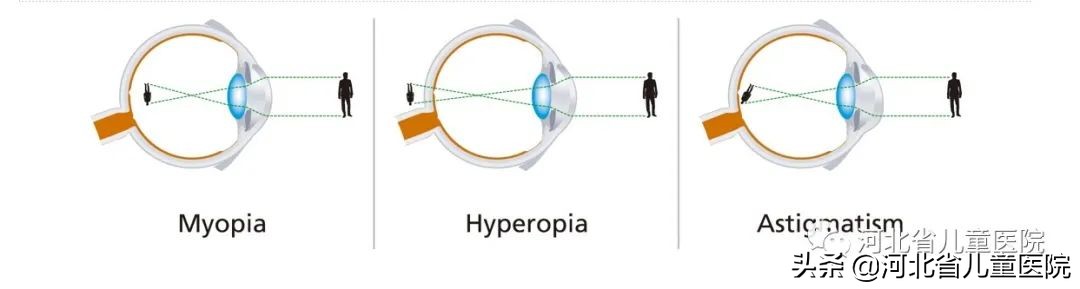 爱眼护眼的重要性文字,爱眼护眼的问题有什么
