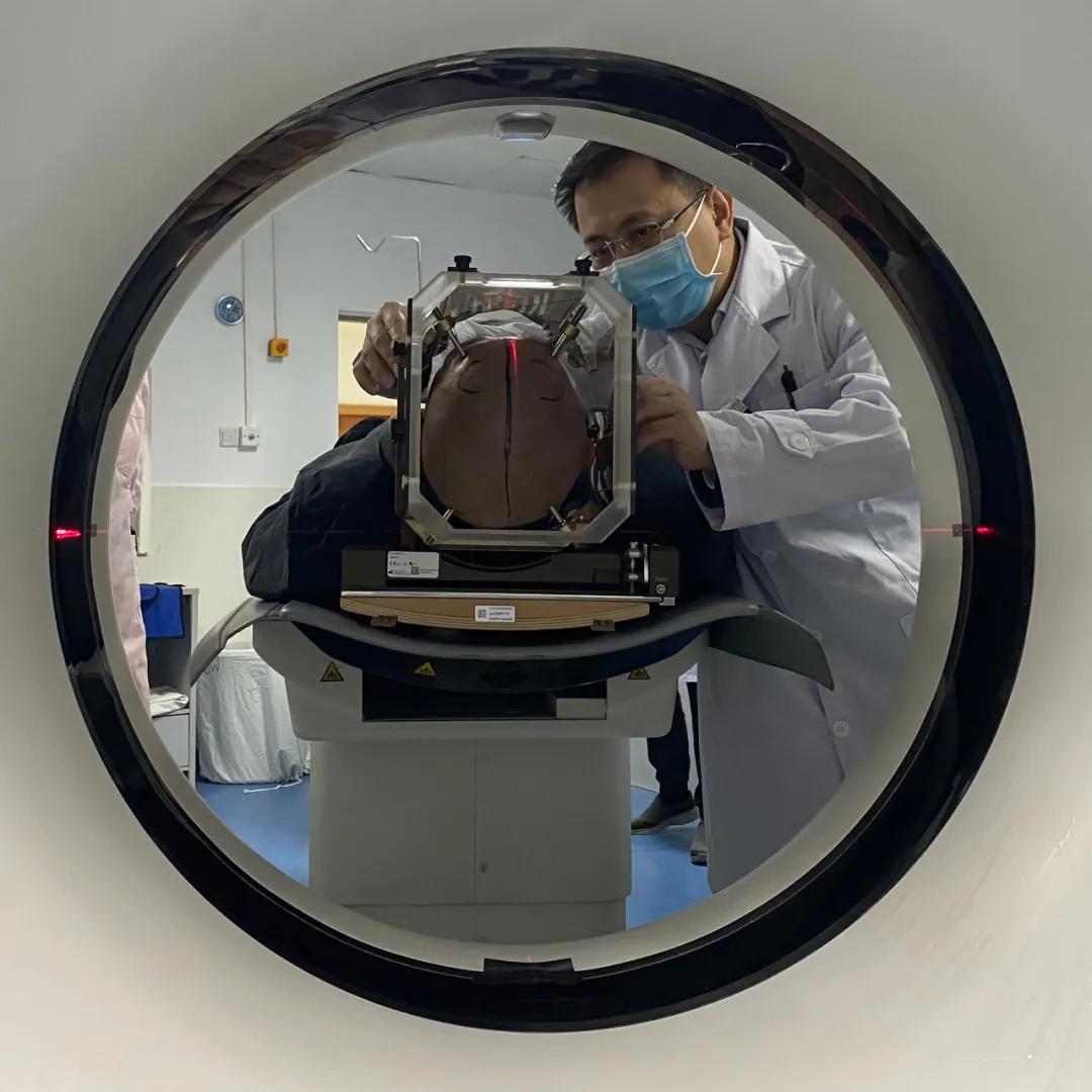 帕金森手术植入电极最新疗法,帕金森植入微米电极