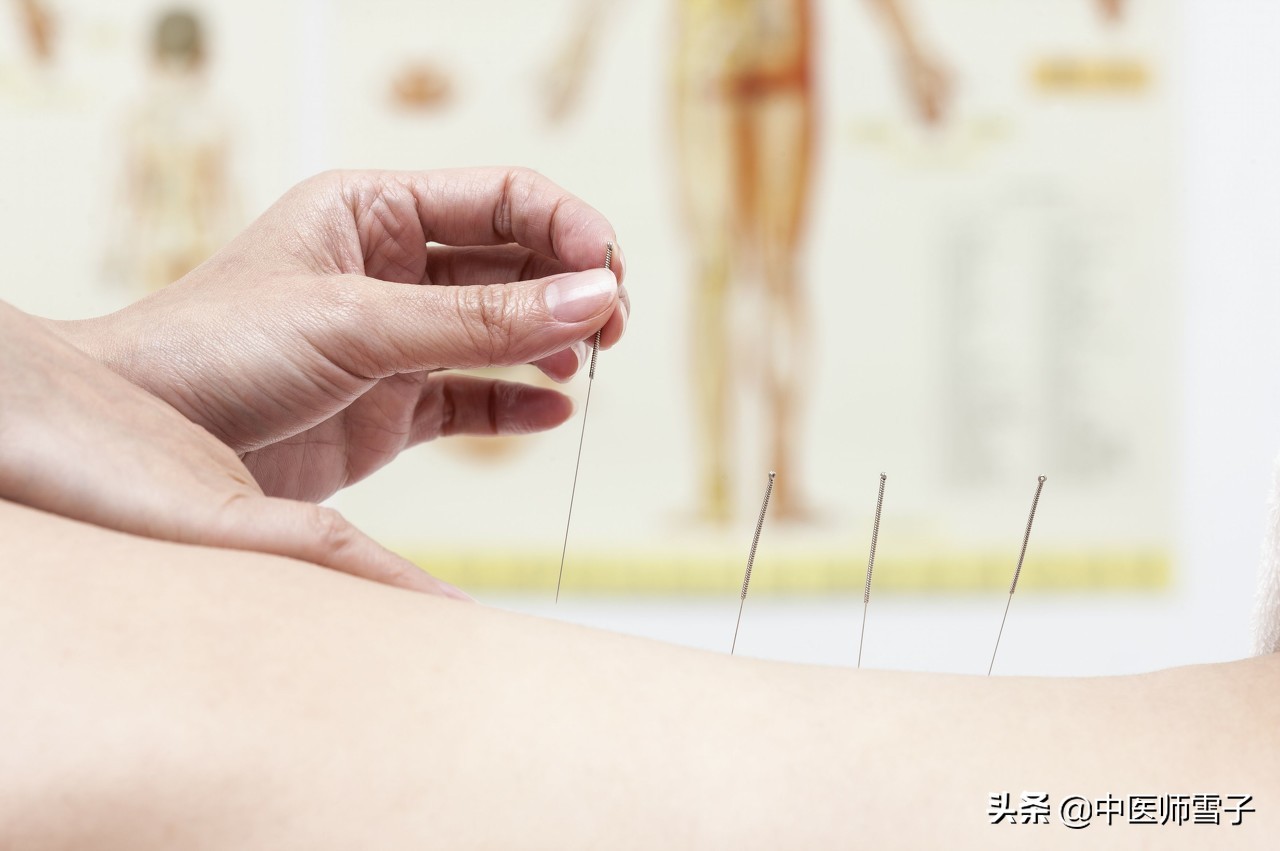 刮痧艾灸拔罐治富贵包,针灸拔罐艾灸能一块做吗