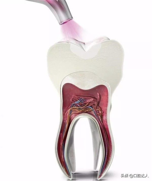 后牙选什么材料补牙,补牙材料太多啦感觉牙不舒服