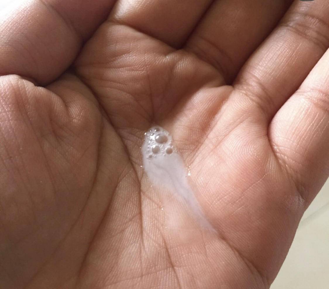 做好清洁有利于祛痘吗,清洁护肤品怎么做的好用