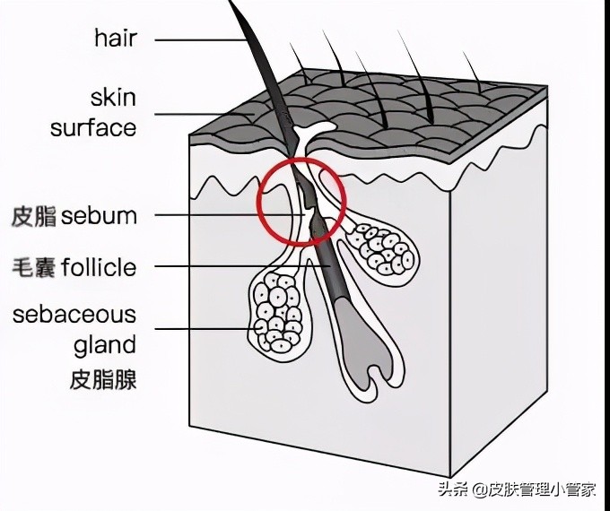祛斑祛痘皮肤管理,皮肤管理祛痘有效吗