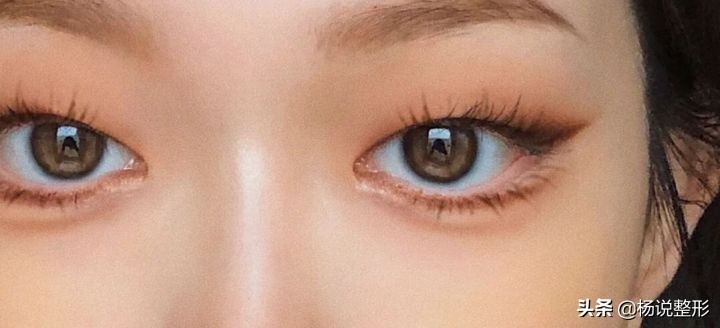 割双眼皮一定好看吗,割双眼皮真的好看吗