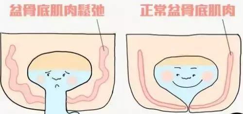 为什么2胎耻骨分离耻骨还特别痛,耻骨疼耻骨分离是要快生了吗