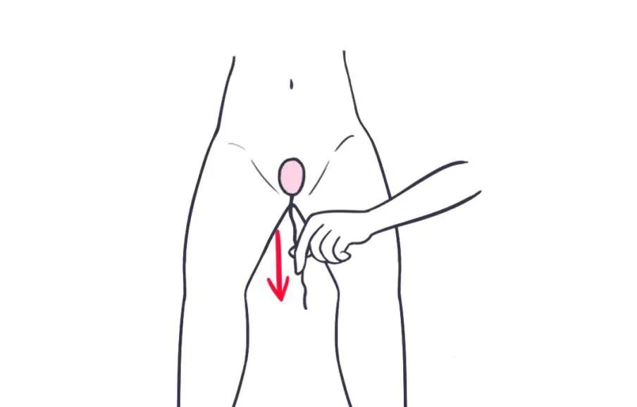 产后修复哑铃是修复什么的,产后为什么哑铃总是掉出来