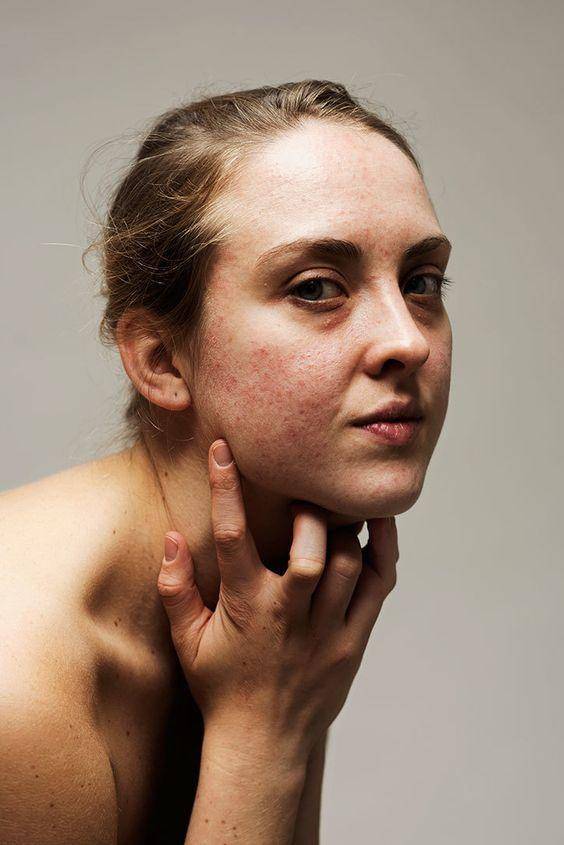 濂崇敓鐖嗙棙蹇呬拱娓呭崟鑽啅,鐖嗙棙浜у搧蹇呬拱娓呭崟