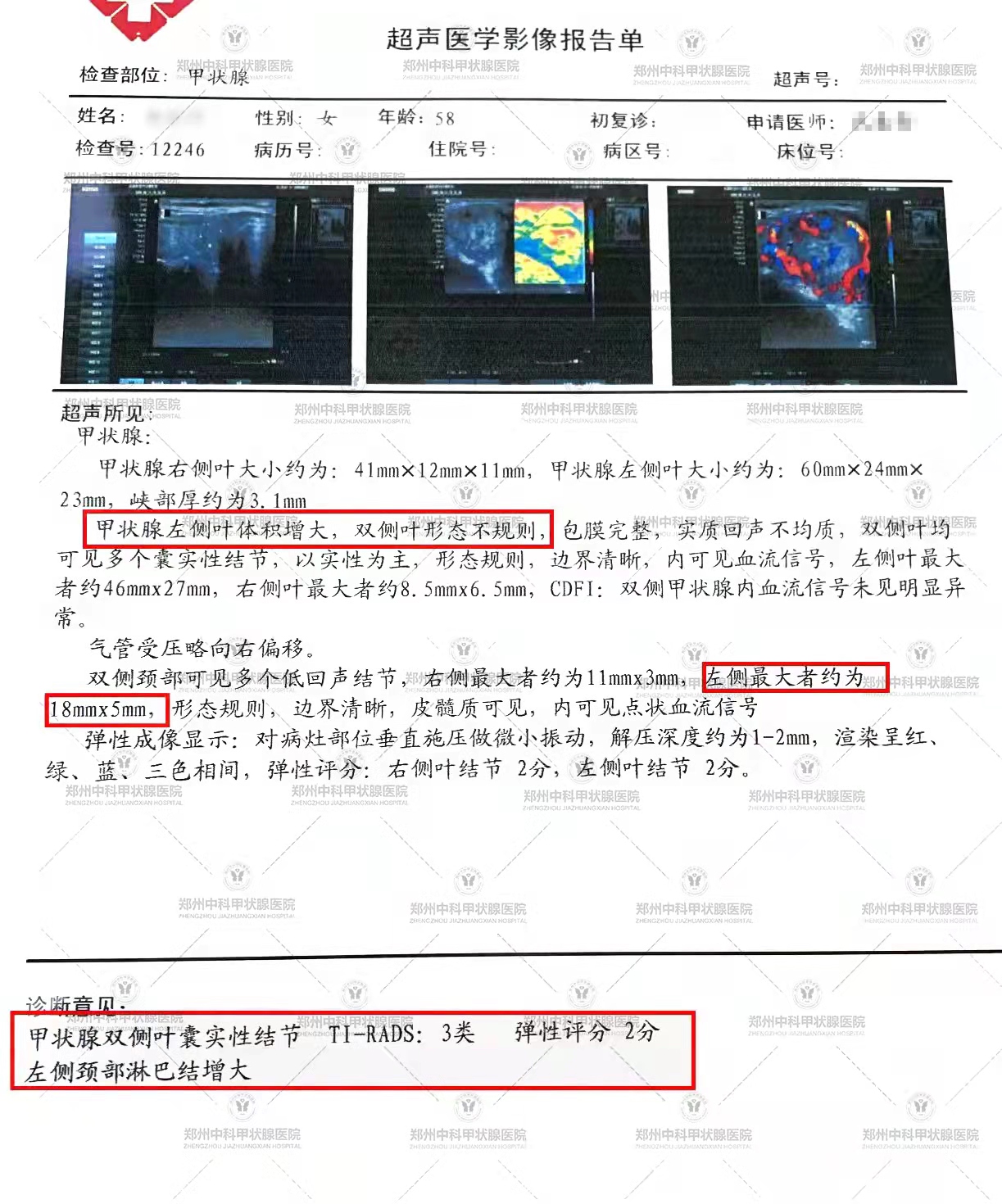甲状腺结节会因为生气而变大吗,甲状腺结节会因为生气变大吗