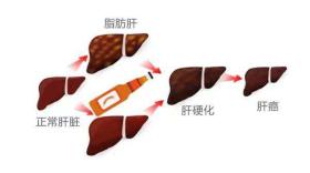 31岁小伙惊变“小黄人”!医生:这个罪魁祸首太多人喜欢了