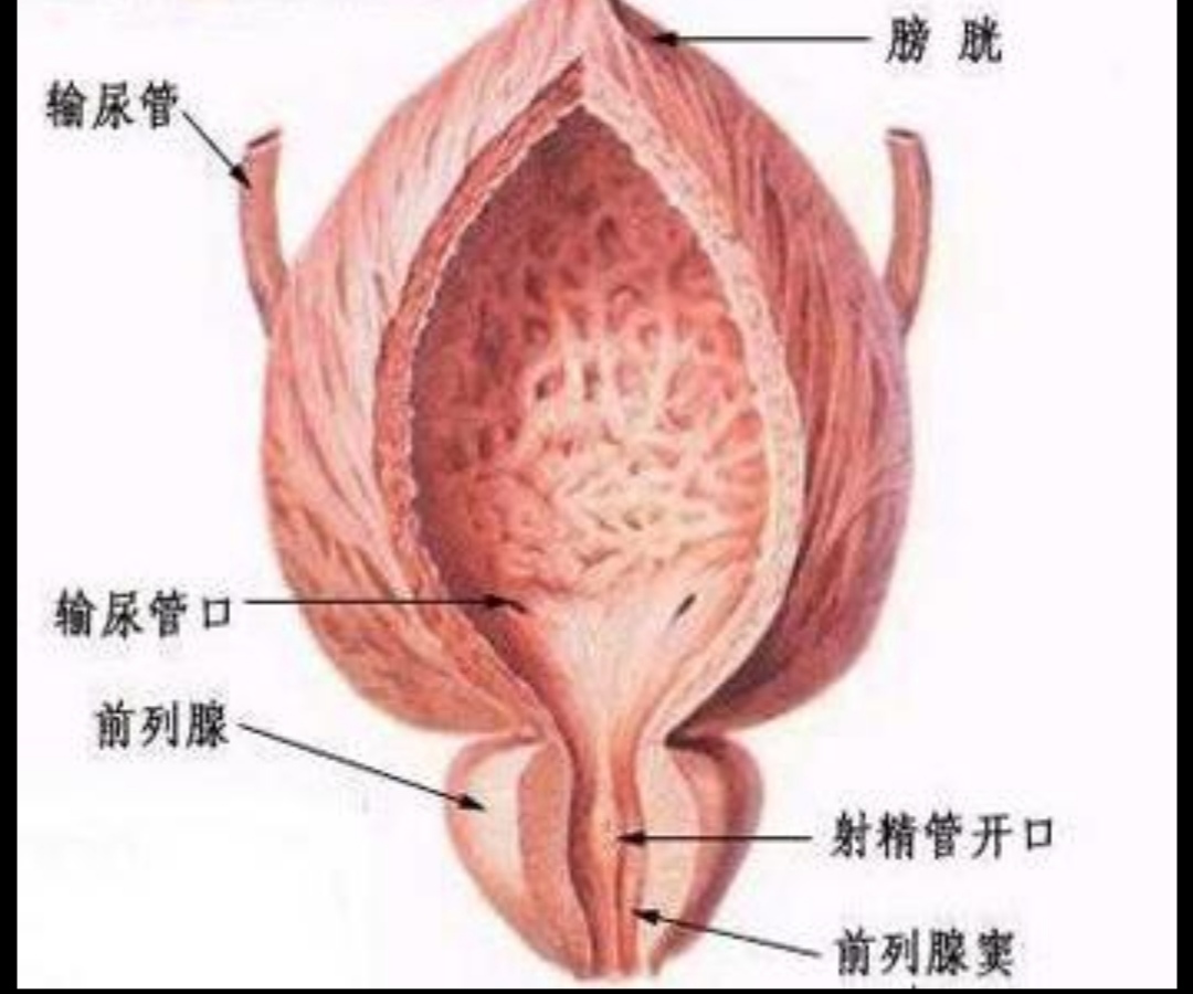 用药抹关元穴治前列腺增生有用吗,我有前列腺增生又有脑梗怎么用药