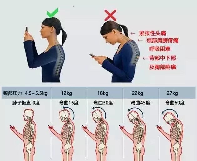 有多少脊椎病,是按出来的?