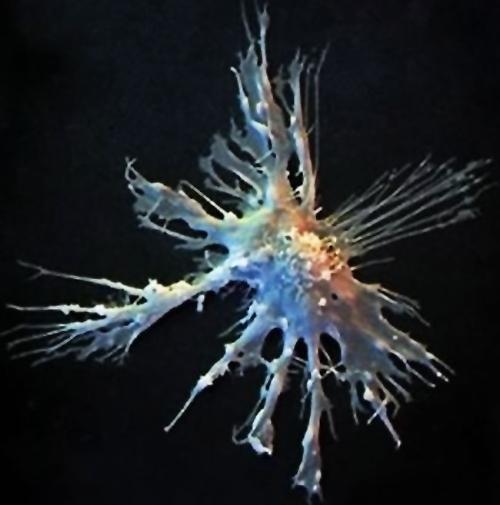 看不见的病毒,看不见的战争完整版