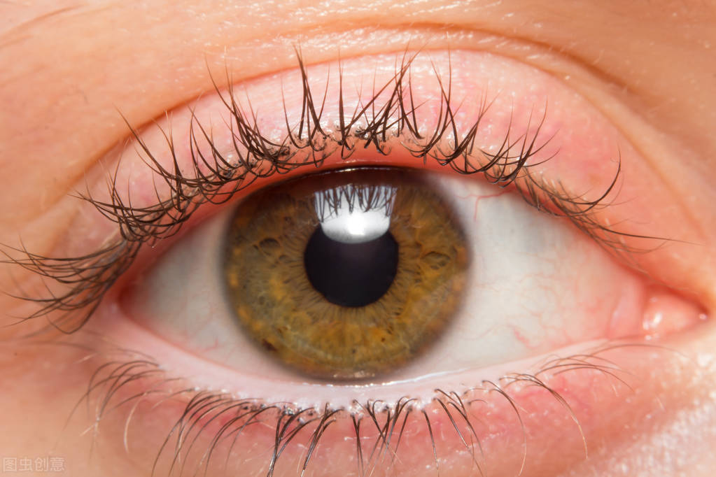 致盲杀手青光眼要如何防治,黄斑病变多久会失明能手术吗