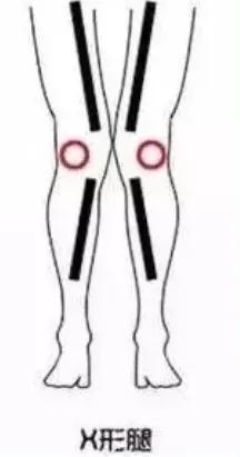 腿型不好会显短吗,牛仔裤哪个版型显高显瘦修饰腿型