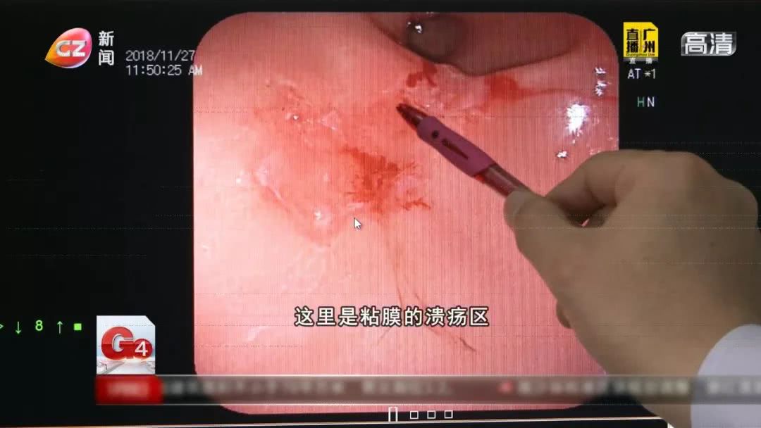 胃疼忍着会伤胃吗,胃疼强忍着