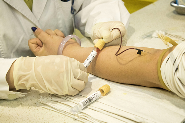 肝功检查单纯的胆红素偏高要紧吗,肝脏正常胆红素偏高还用查什么