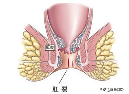 愿意让老公体会生孩子的痛吗,男生尝试生孩子的疼痛