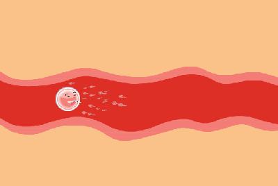 「张院讲故事」输卵管不是下水道!千万不要随便通!损伤不可逆