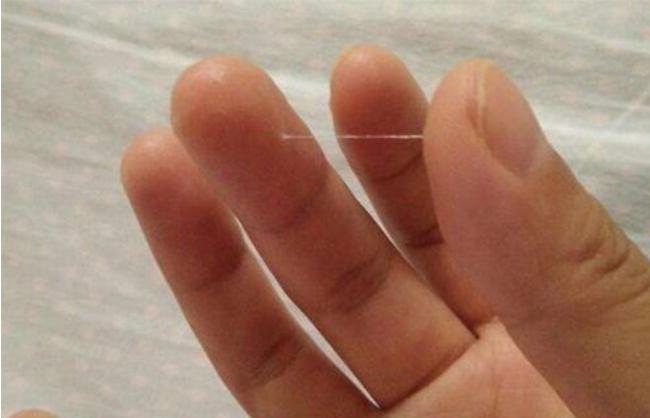 排卵期白带褐色是怀孕了吗,排卵期白带多是卵子质量好吗