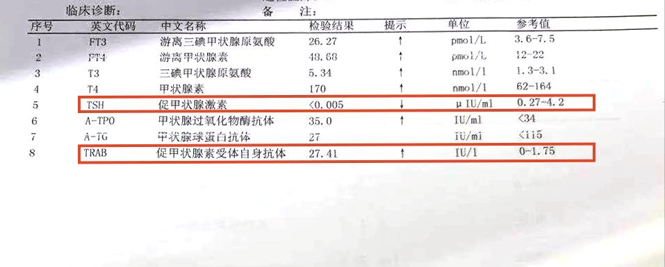桥本轻微甲亢,桥本甲亢5年还没好