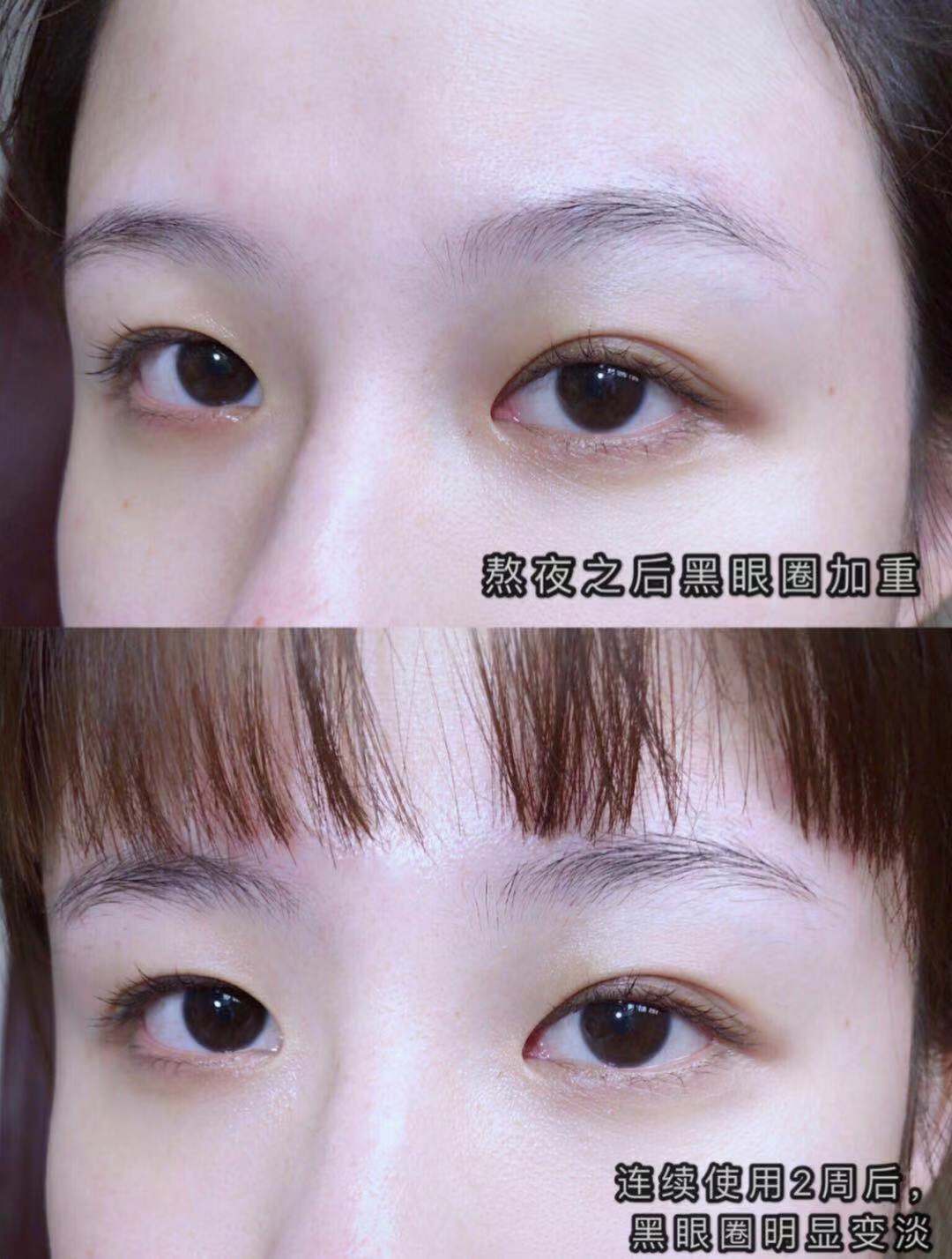 有句话说得好：美不美看脸，老不老看眼