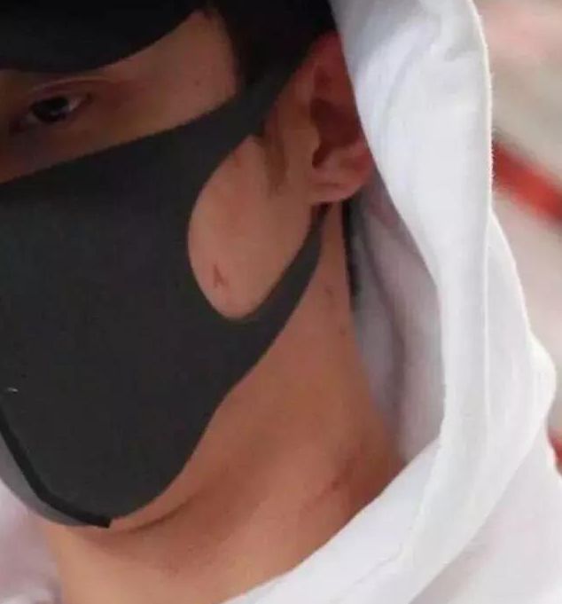 被绿又被打？还为爱自杀？至于吗