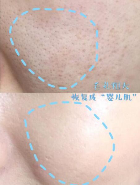 做美容的女人勇气可嘉,打了美容针的女人现在怎么样了