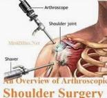 医学基础知识关节学,关节镜前世今生