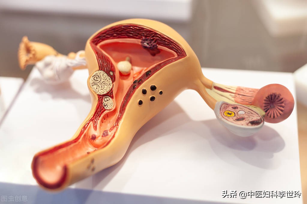 得了子宫肌瘤就不能生健康的宝宝？中药调理给宝宝一个健康的房间