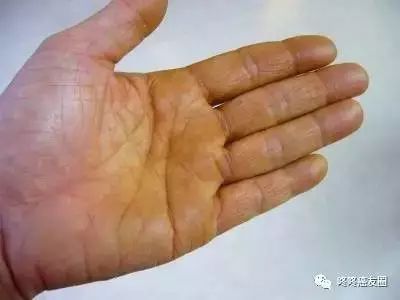 肿瘤全套血检报告怎么看,肿瘤肝功能指标怎么看