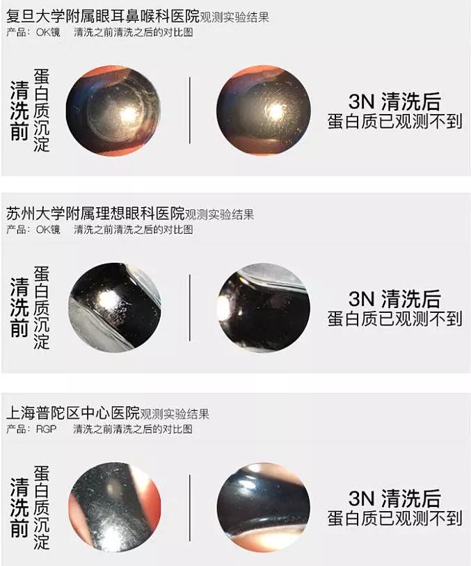 隐形眼镜清洁器升级版,智能隐形眼镜清洗器